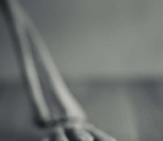 골다공증 예방, 건강한 뼈 지키는 생활습관이 해답이다 gray rope in grayscale photography